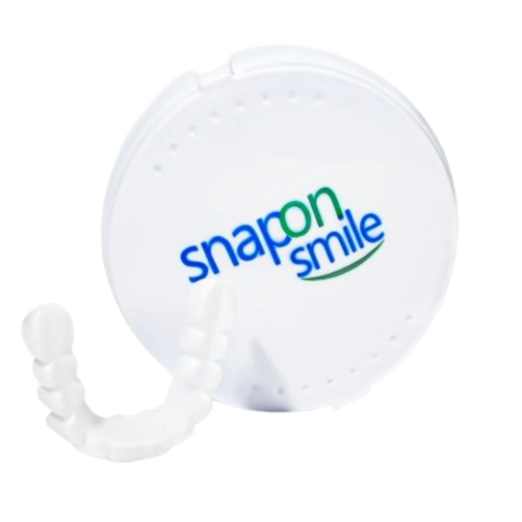 Snap-On Smile Removable Veneers